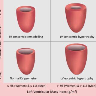 lv geometry diagram